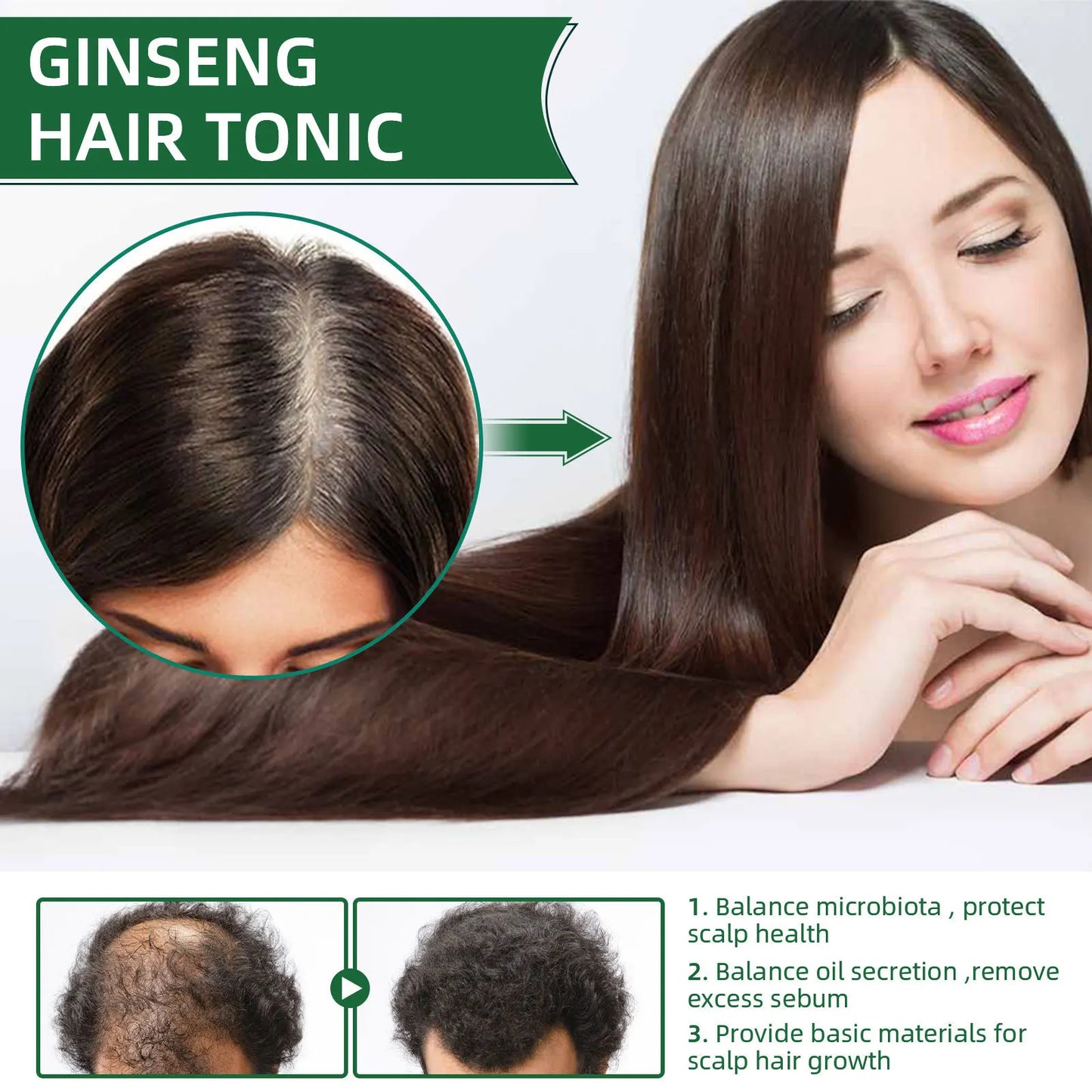 Ginseng Hair Growth Spray; Moisturize Nourish Scalp