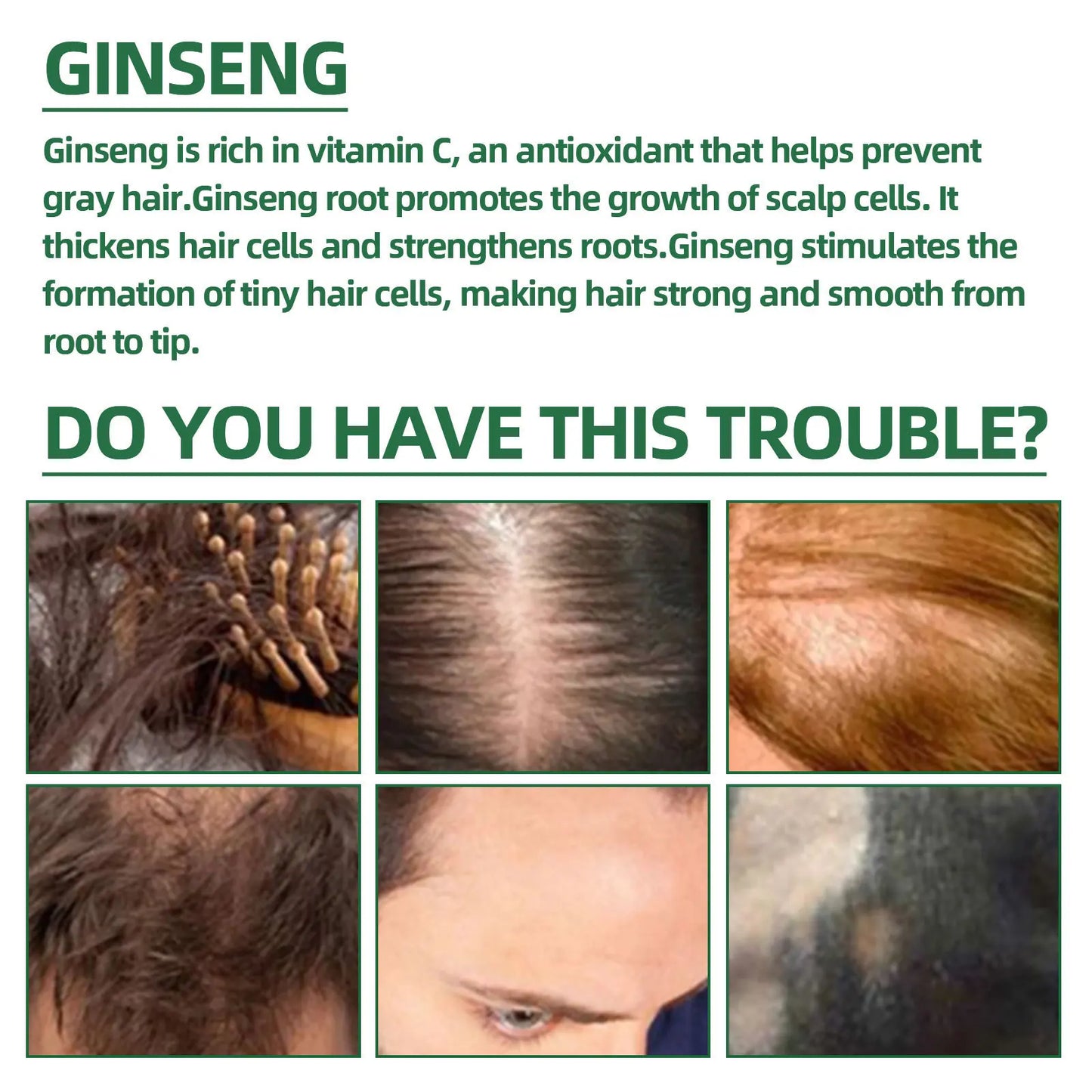 Ginseng Hair Growth Spray; Moisturize Nourish Scalp
