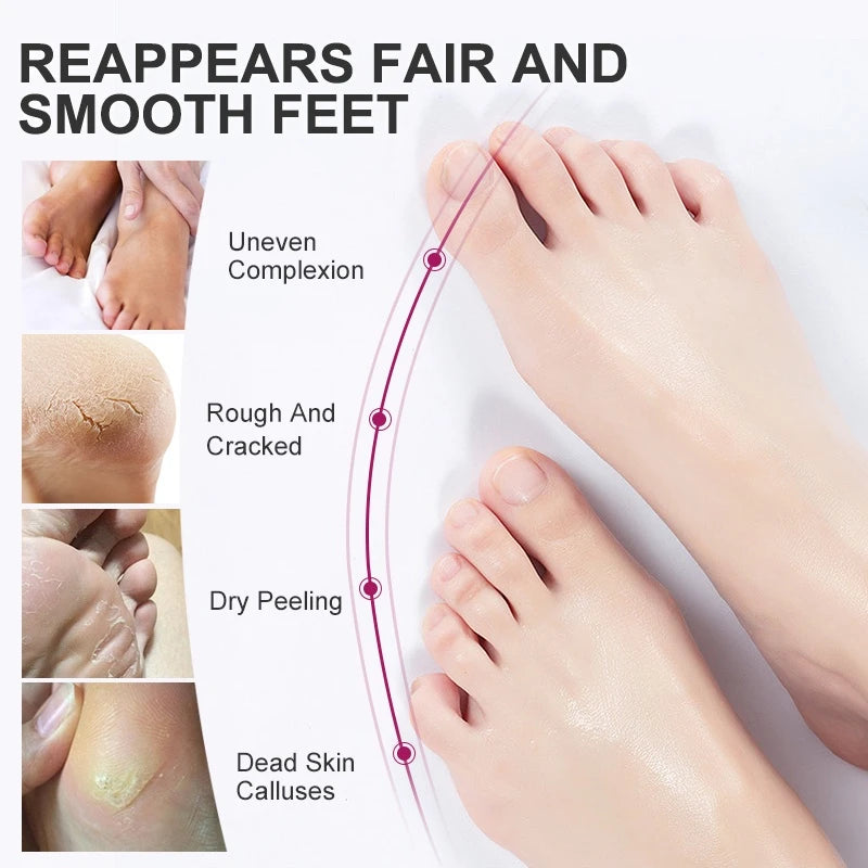 Foot Peel Exfoliating Mask