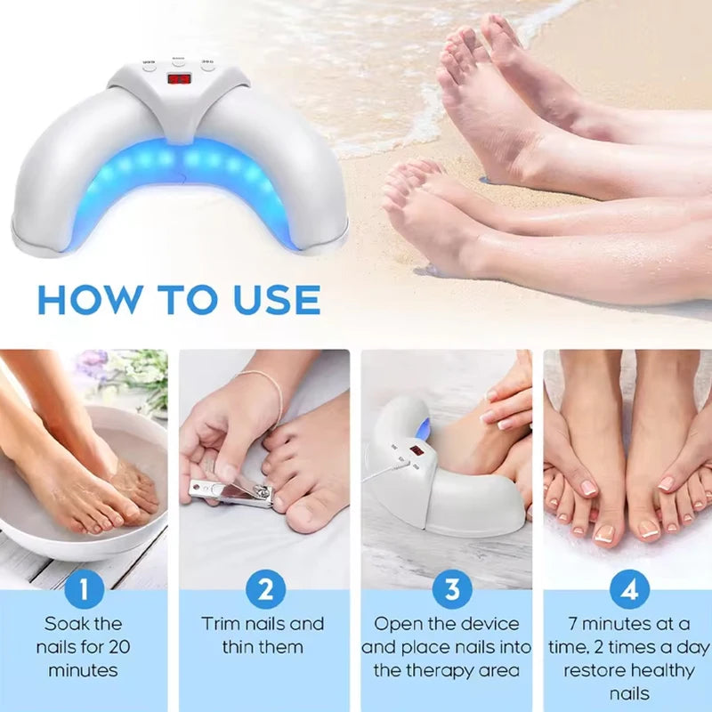 Toenail/Fingernail Fungal Repair Laser Device
