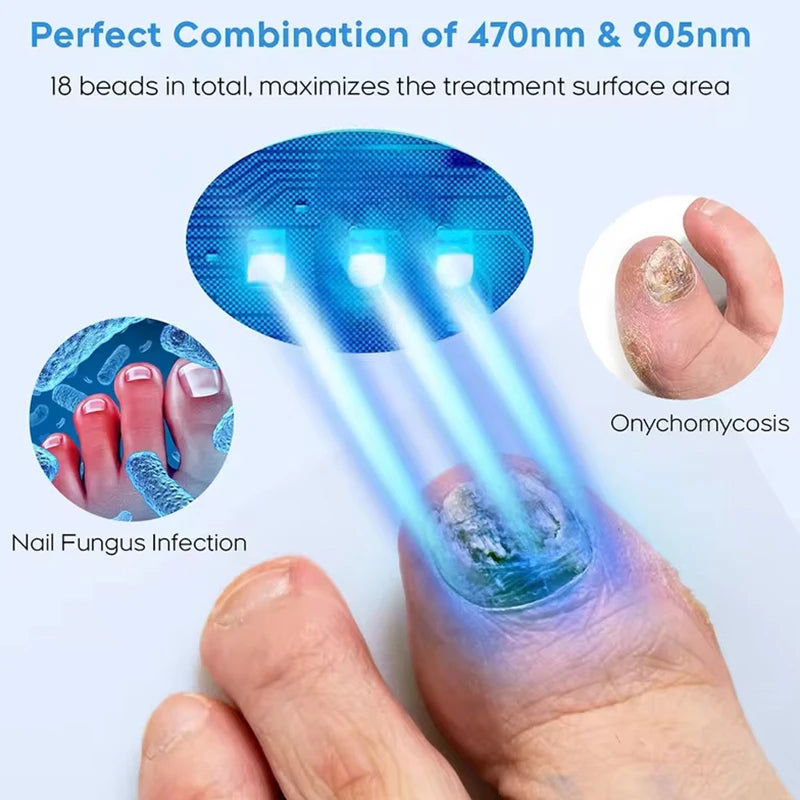 Toenail/Fingernail Fungal Repair Laser Device