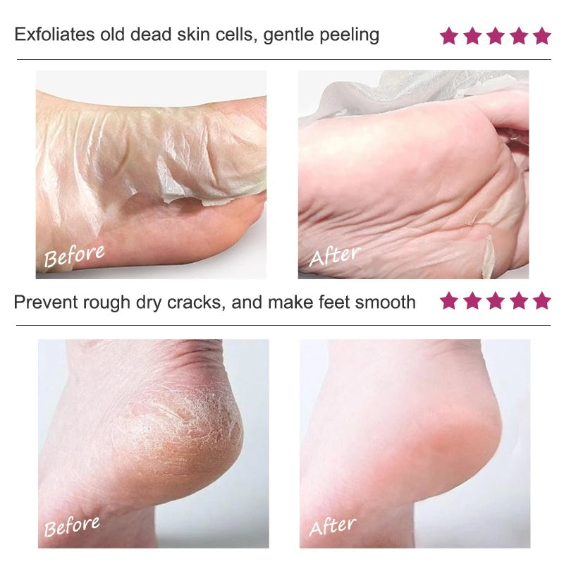 Foot Peel Exfoliating Mask